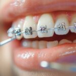 Orthodontic Treatment in Pune