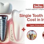 single tooth dental implant