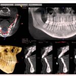 CBCT Scan Near Me