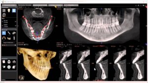 CBCT Scan Near Me