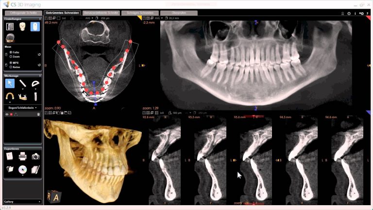 CBCT Scan Near Me