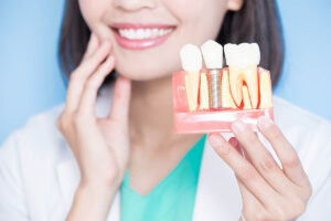 Same-Day Dental Implants Treatment