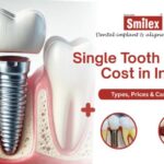 Single Tooth Implant Cost in India