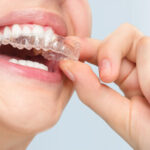 invisalign in pune