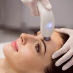 laser hair removal laval