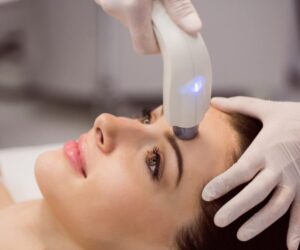 laser hair removal laval