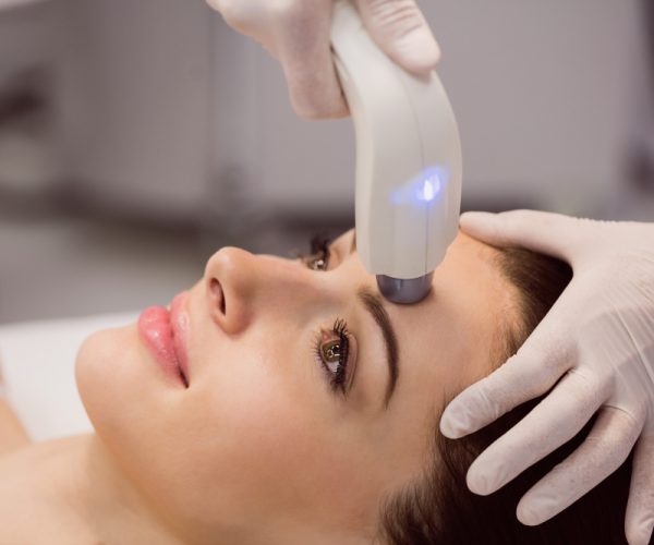 laser hair removal laval