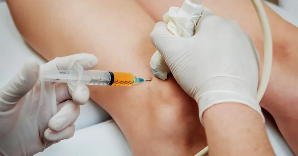 regenerative-medicine-ultrasound-guided-prp-injection-1200x628
