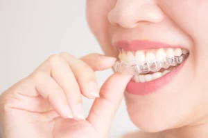 GSD-Straighten-Your-Teeth-with-Invisalign®-Clear-Aligners-Blog