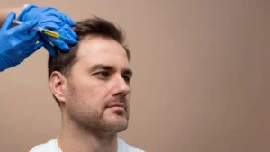 PRP hair treatment Toronto