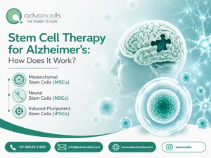 Stem-Cell-Treatment-for-Alzheimer's