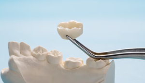 dental crowns st petersburg fl