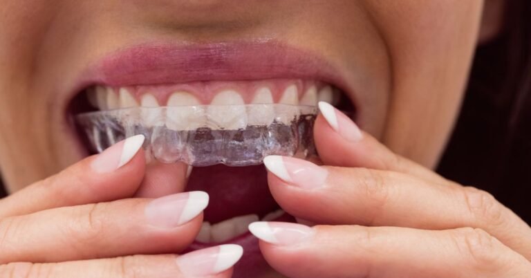 Clear Aligners Pell City AL for Comfortable and Discreet Teeth Straightening
