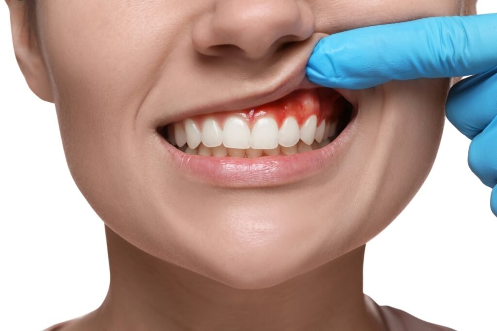 Dental Care Bremen GA for Healthy Teeth, Gums, and Confident Smiles