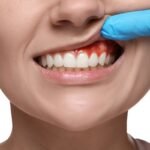 Dental Care Bremen GA for Healthy Teeth, Gums, and Confident Smiles