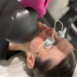 IPL skin rejuvenation