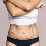Tummy Tuck In Dubai