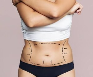 Tummy Tuck In Dubai