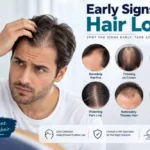 Early Signs of Hair Loss