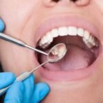 Root Canal Treatment