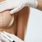 Breast Lift Surgery in Islamabad