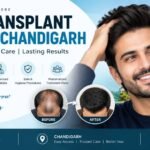 hair transplant clinic in Chandigarh