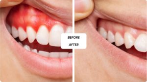 General Dentistry in Dubai