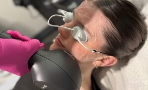 ipl skin rejuvenation Edmonton