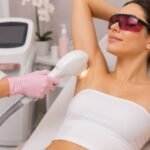 laser hair removal service Edmonton