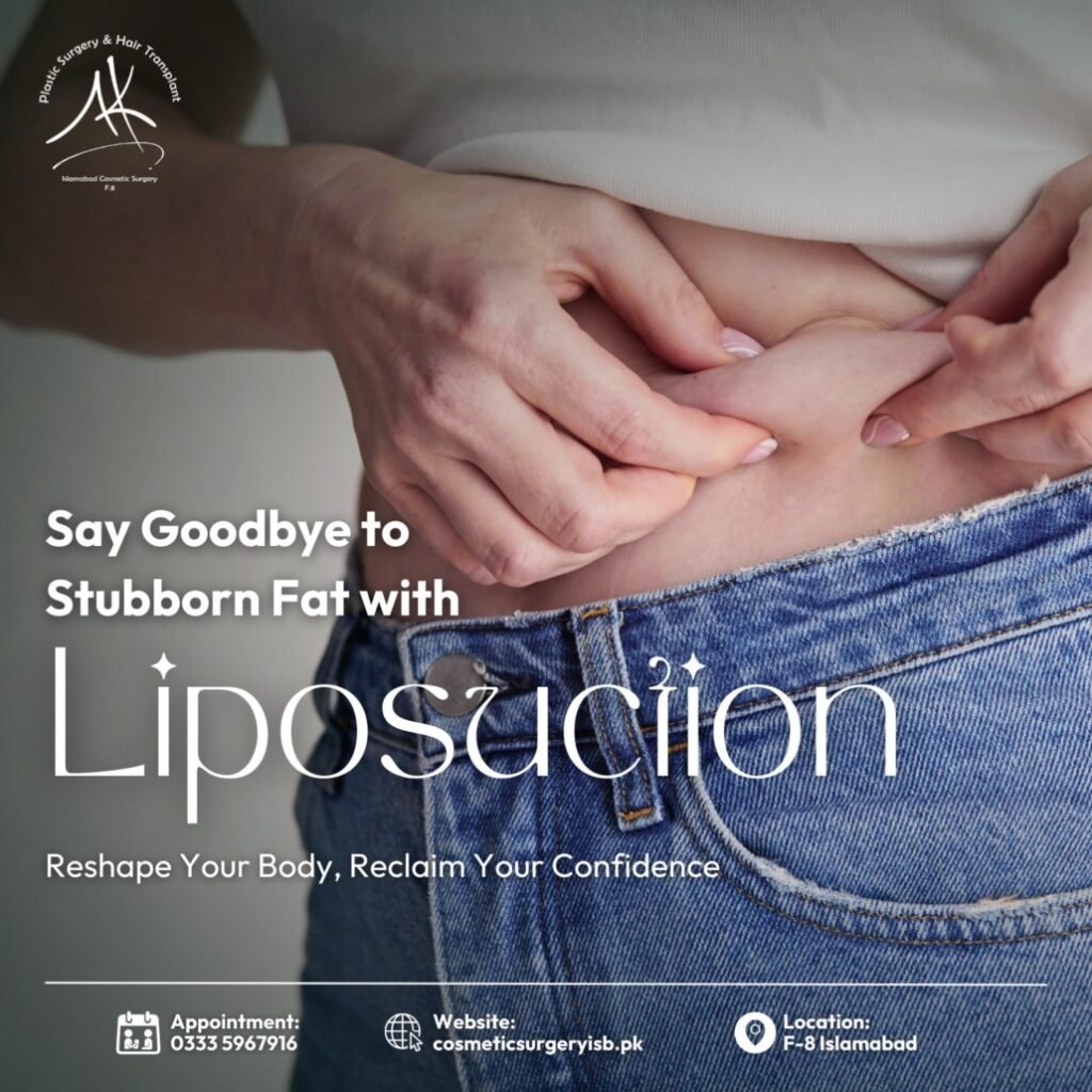 liposuction in islamabad