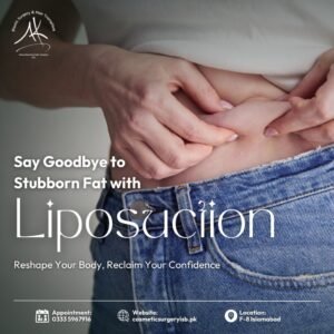 liposuction in islamabad