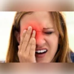 Blepharitis Herbal Treatment for reducing eyelid redness and irritation with gentle eye care