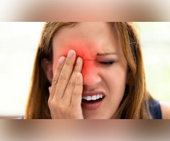 Blepharitis Herbal Treatment for reducing eyelid redness and irritation with gentle eye care
