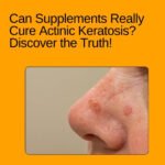 Supplements for Actinic Keratosis and natural skin health support