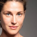 Lower-Blepharoplasty-London