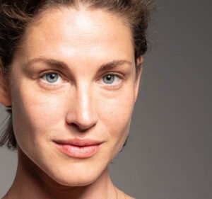 Lower-Blepharoplasty-London