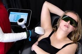Laser hair removal Edmonton